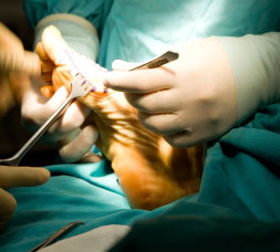 Foot Surgery